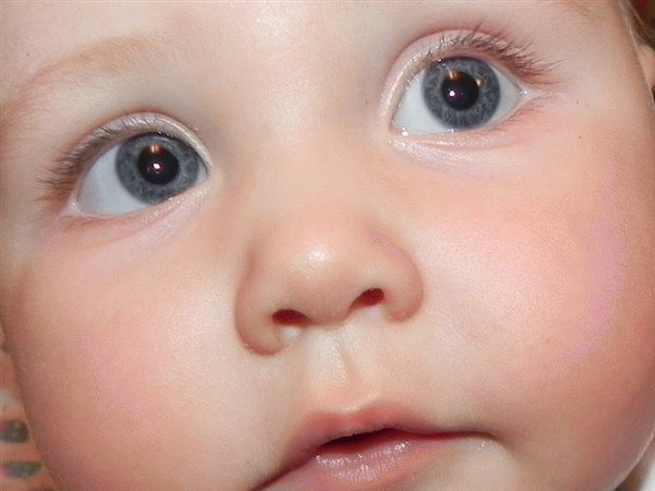 Белки глаз новорожденного. Детские глаза. Глаза новорожденного. Косоглазие у детей.