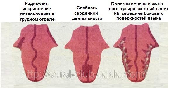 Фото болезней по языку с картинками
